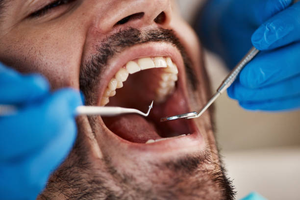 Best Emergency Treatment for Dental Infections or Abscesses in Thatcher, AZ